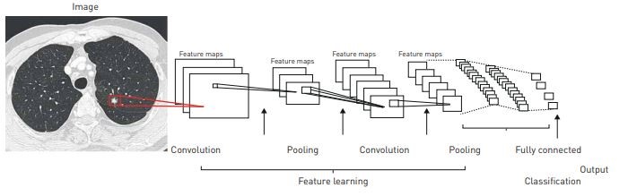 feature learning